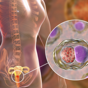Infections sexuellement transmissibles